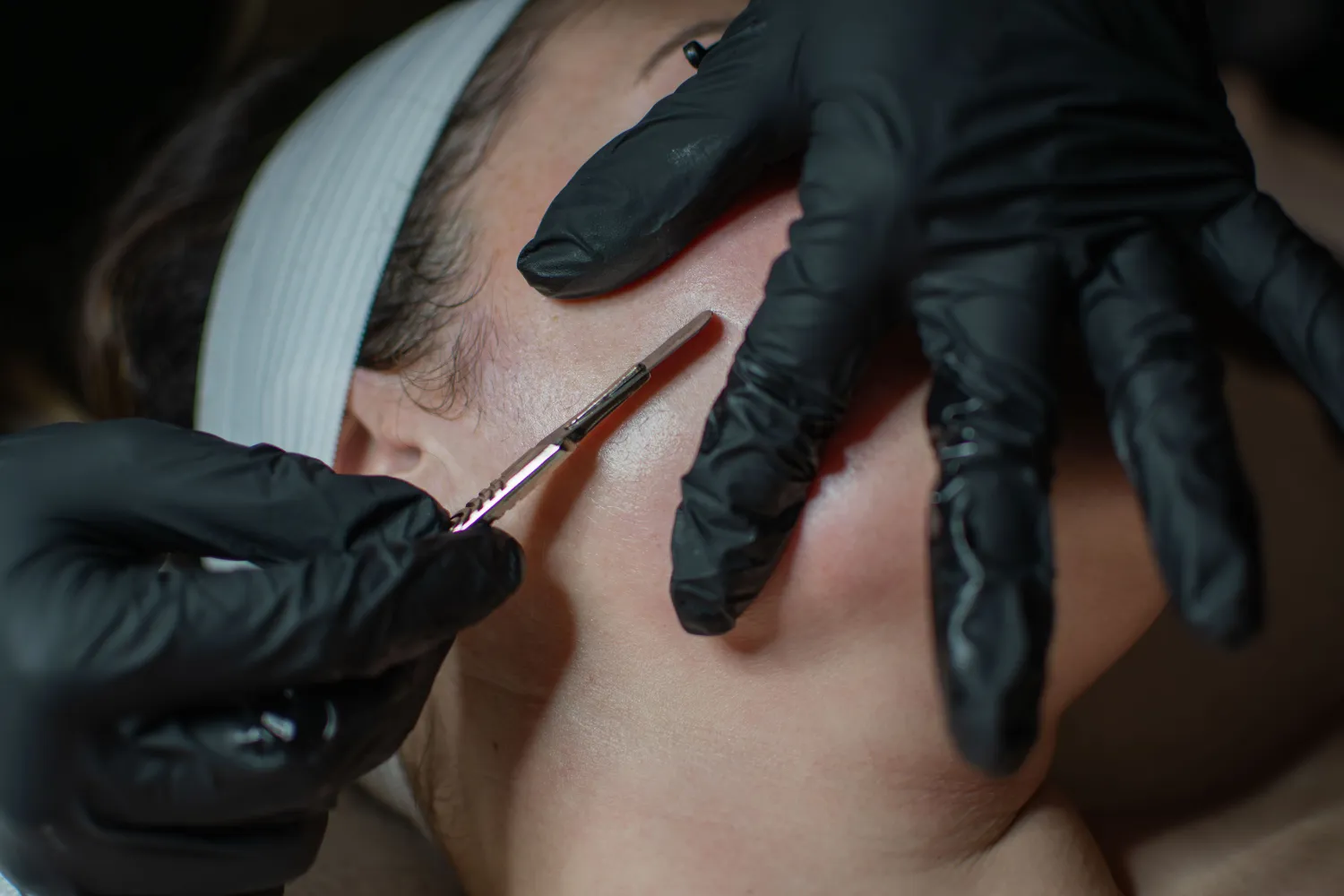 Dermaplane Treatments