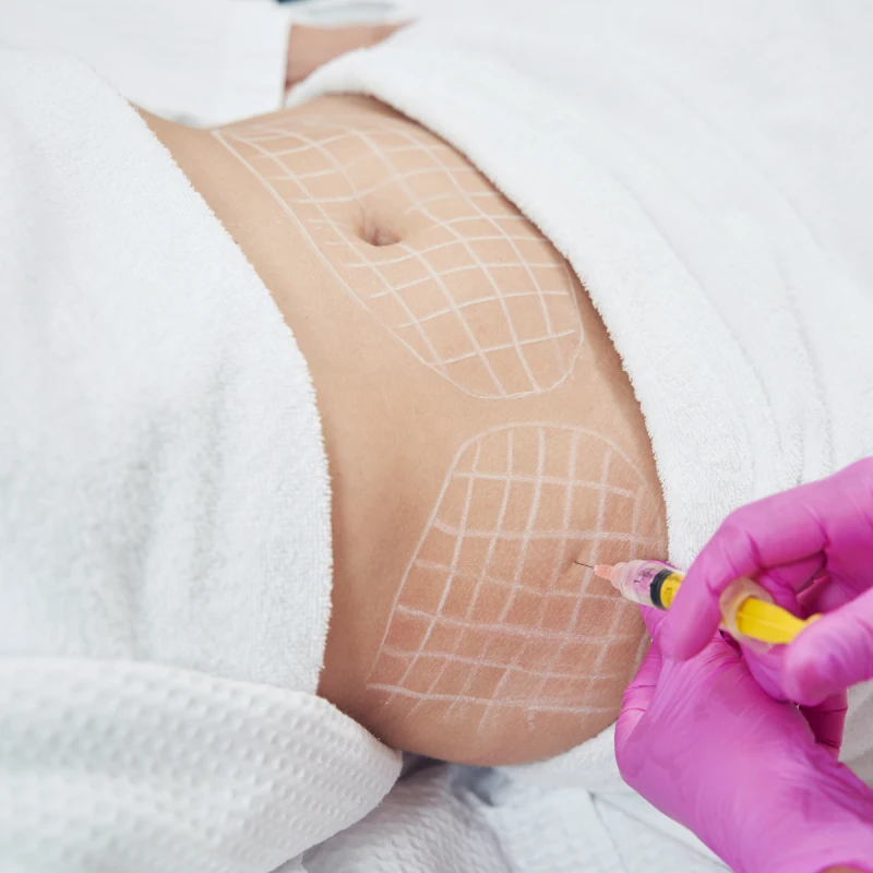 Fat-Dissolving Injections
