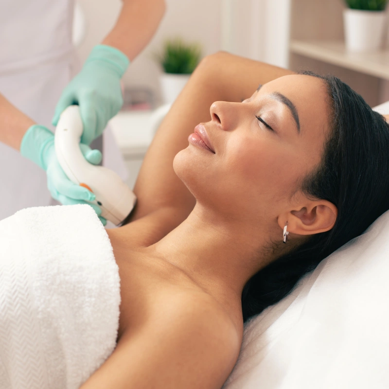 Laser Hair Removal