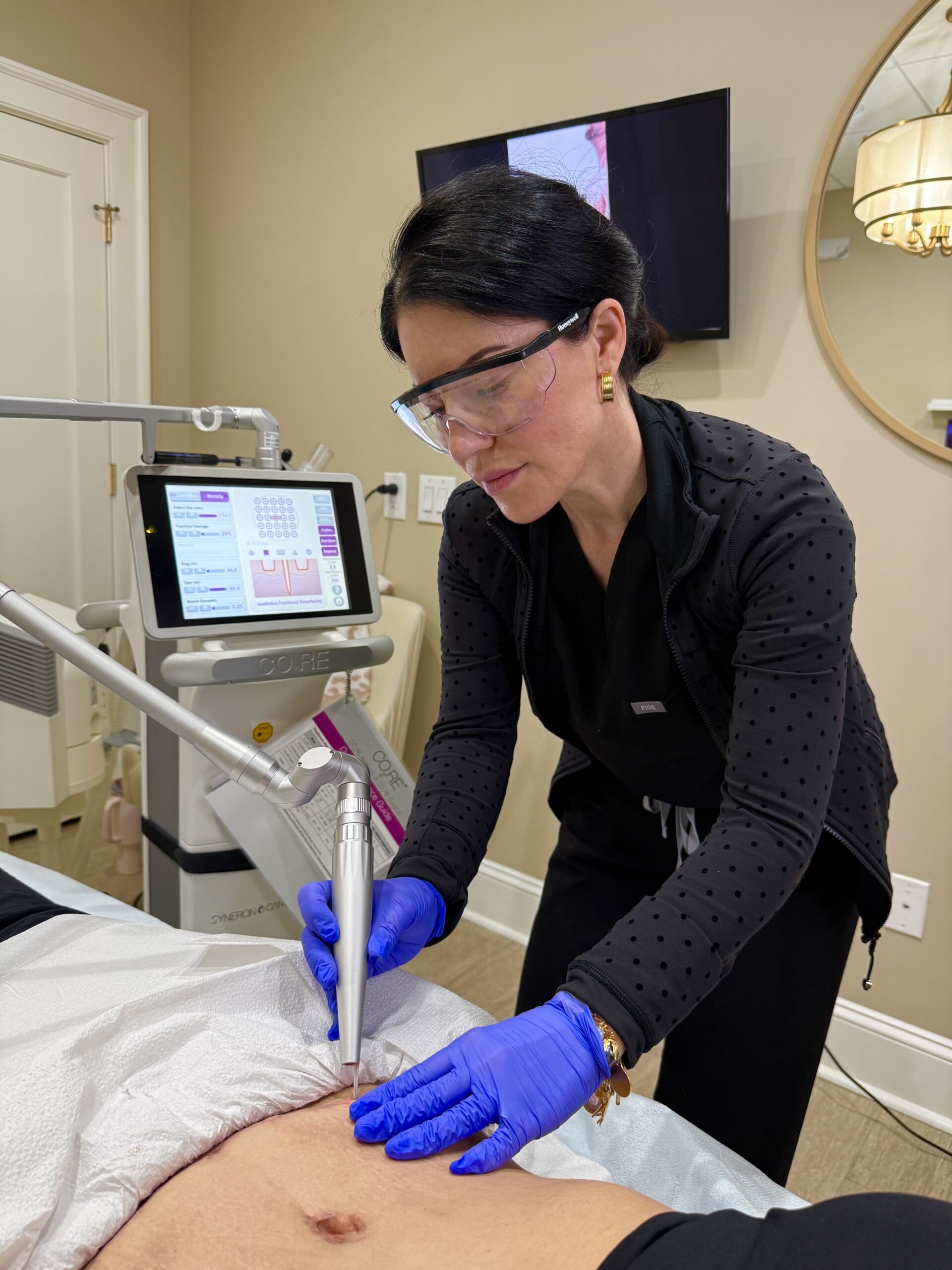 CO2 Laser treatment